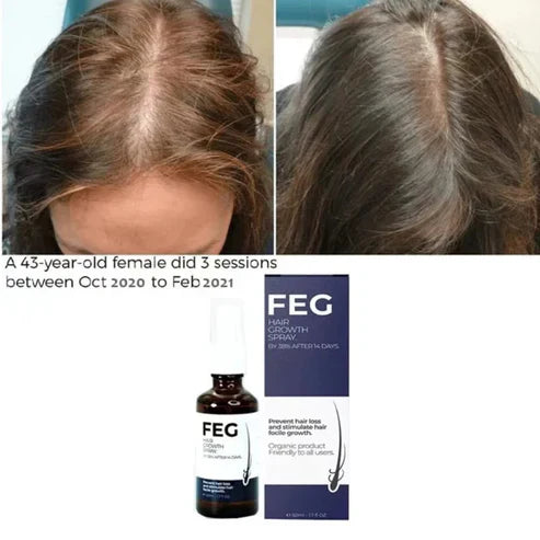 FEG Plus Hair Growth Spray – Regrow Hair Fast & Safely