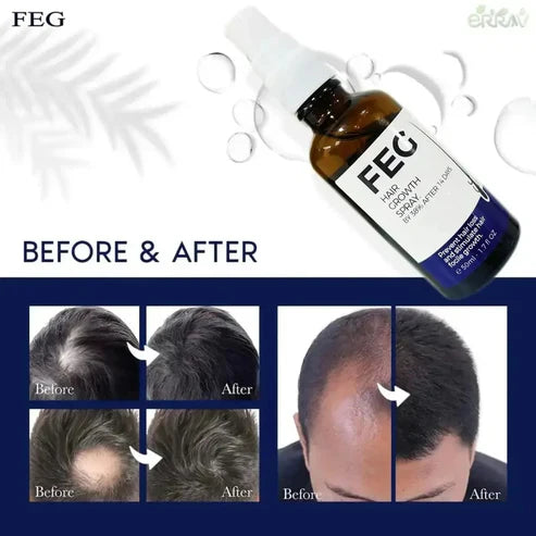 FEG Plus Hair Growth Spray – Regrow Hair Fast & Safely