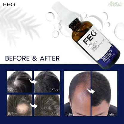 FEG Plus Hair Growth Spray – Regrow Hair Fast & Safely